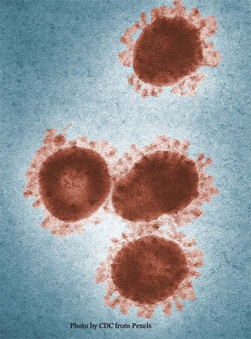 Microscopic Photo of Coronaviruses