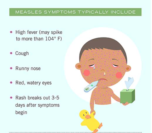 Measles