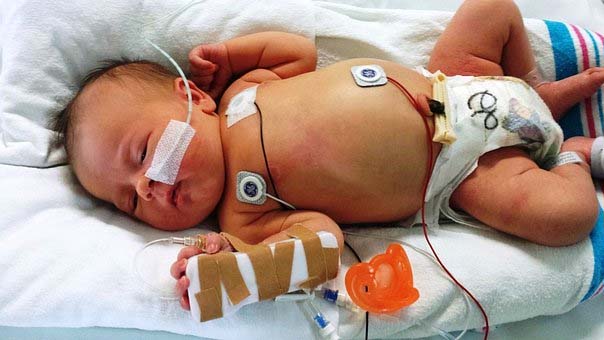 Sick Newborn Baby