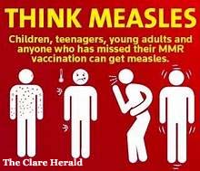 Think Measles