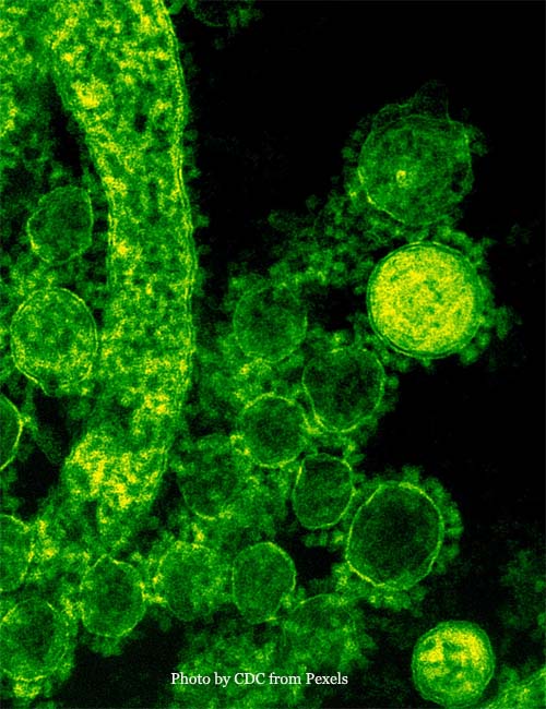 Microscopic Photo of a Virus